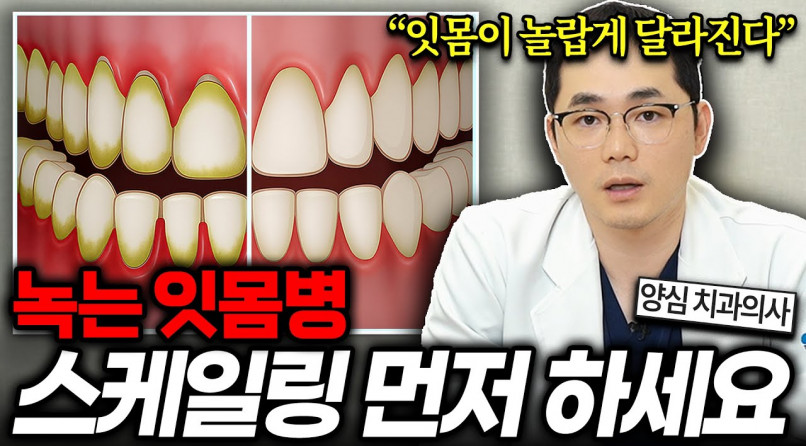 유튜브 썸네일 3